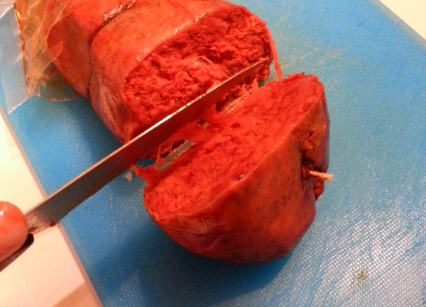 Calabrian Nduja